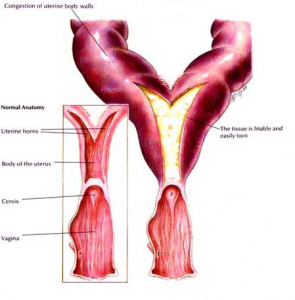 Pyometra